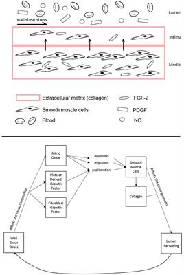 Patient-Specific, Multi-Scale Modeling of Neointimal Hyperplasia in Vein Grafts